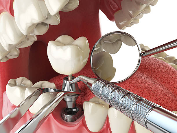 Best Weekend Emergency Dentist in Walbridge, OH